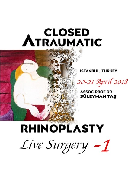 Kapalı Atravmatik Rinoplasti Canlı Cerrahi DVD