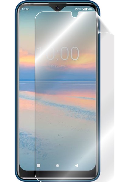 Casper Vıa A4 Görünmez Ekran Koruyucu