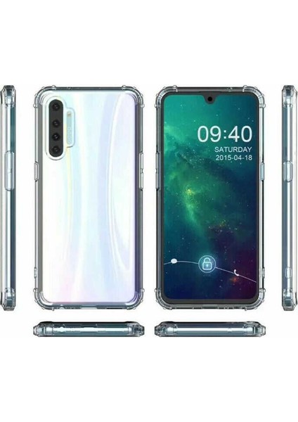 Case Street Realme Xt Kılıf Antishock Ultra Koruma Sert Kapak Şeffaf