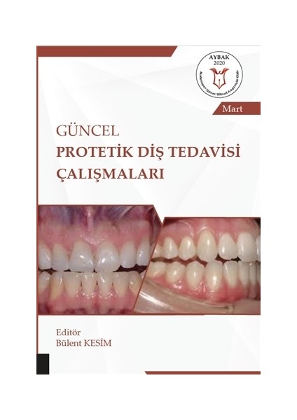 Güncel Protetik Diş Tedavisi Çalışmaları - Mart - Bülent Kesim