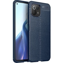 Tstore Xiaomi Mi 11 Lite Kılıf Focus Derili Silikon