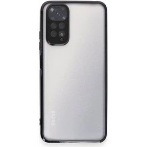 Xiaomi Redmi Note 11 Kılıf Razer Lensli Silikon
