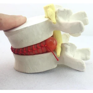 Disk Hernisi   Maketi Model 2