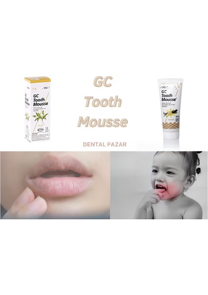 Gc Tooth Mousse Çilek Aromalı 40 gr