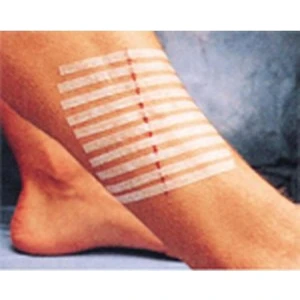 3m Steri-Strip Dikiş Bantları 12MM x 100MM 6 Adet Şerit R1547 3m