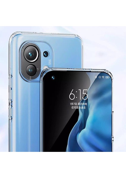 Gor Xiaomi Mi 11 Kılıf Kamera Korumalı Şeffaf Silikon Kılıf modelleri