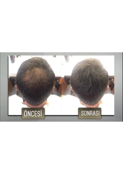 Fibers Saç Dolgunlaştırıcı Saç Fiberi (Topik) -Koyu Kahve modelleri