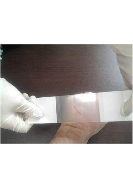 Suprasorb F 10 cm x 1 mt Dövme Koruyucu Örtüsü,