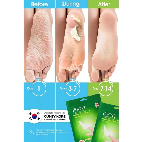 Jigott Çorap Tipi Soyulan Ayak Peeling Maskesi - Miracle Foot Peeling Pack