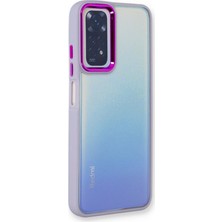 Plus Xiaomi Redmi Note 11 Pro ile Uyumlu Nikelaj Kılıf