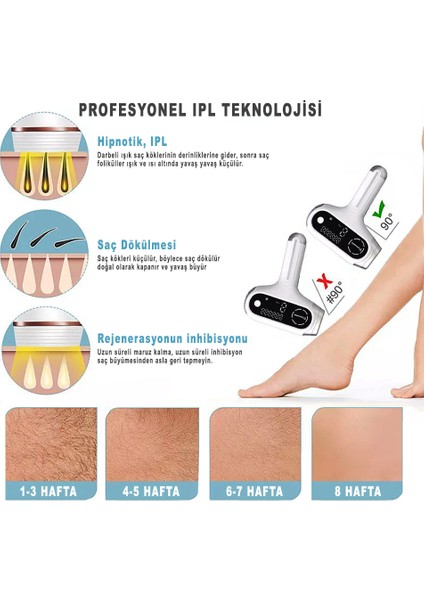 Ipl Buz Lazer Epilasyon Cıhazı 999.999 Atım