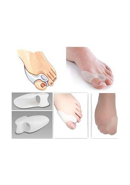 Bunyon Kemik Koruyucu Baş Parmak fırsatları