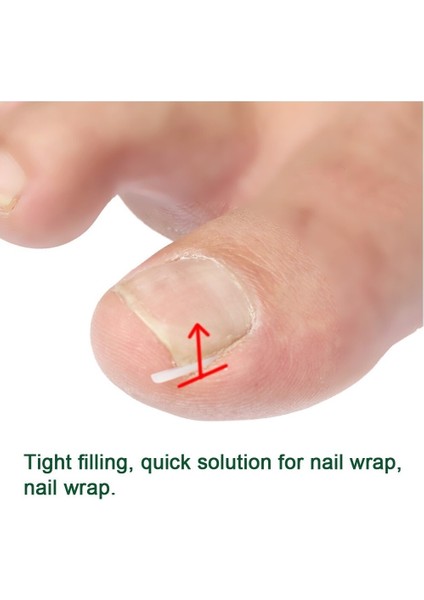 10'lu Batık Ayak Tırnağı Düzeltici Ped Ayak Bakımı (Yurt Dışından) fırsatları