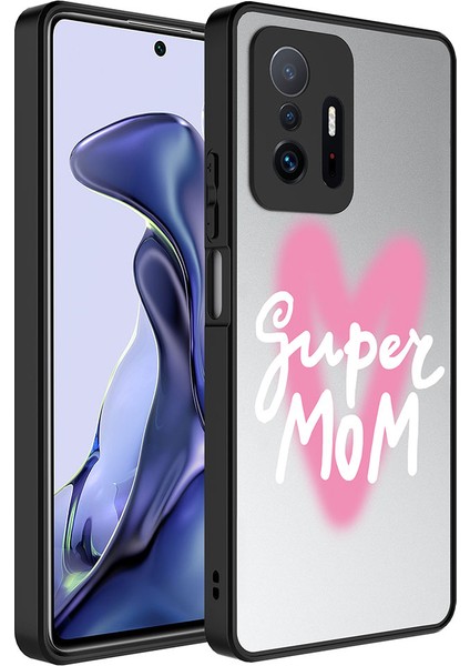 - Xiaomi Mi 11T Pro 5G - Kılıf Aynalı Desenli Kamera Korumalı Parlak Mirror Kapak - Süper Anne - T26807