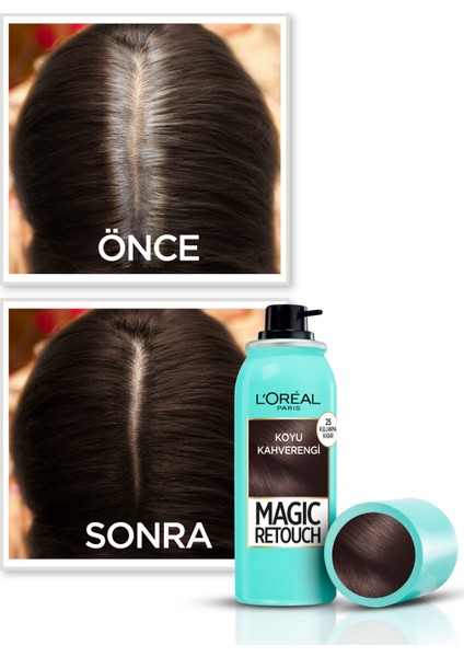 L'Oréal Paris Magic Retouch Beyaz Dipleri Kapatıcı Sprey - Koyu Kahverengi