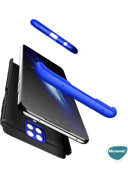 Xiaomi Redmi Note 9 Pro Max Kılıf Double Dip 360 Protective Siyah - Mavi
