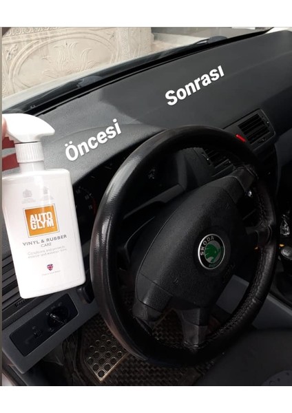 Özel Müşteri Seti