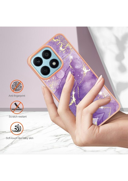 Zsunsky Shop- Honor X8A Için Mermer Kılıf (Yurt Dışından) indirimleri