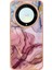 Honor X9A Tpu Telefon Kılıfı X9A 5g / Magic5 Lite 5g / X40 5g, Mermer Desen 2.0mm Imd Elektrografa Kapağı (Yurt Dışından) 2