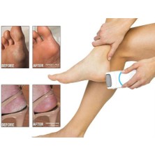 Personal Pedi Ayak Topuk Temizleyici