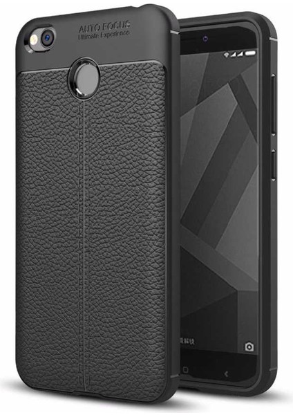Xiaomi Redmi 4x Kılıf Deri Görünümlü Tam Koruma Orjinal Silikon