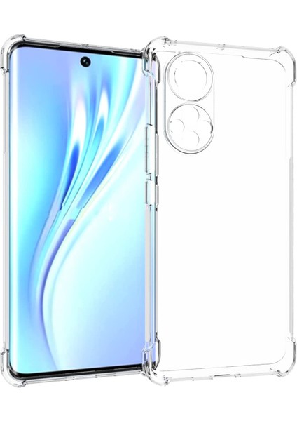 Caseworld Huawei Nova 9 ile Uyumlu Kapak Kamera Korumalı Airbag Antishock Köşe Korumalı Şeffaf Silikon Kılıf