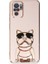 Xiaomi Redmi Note 10 Case Kılıf Kamera Korumalı Köpek Desenli Standlı Silikon Pembe 1