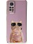 Xiaomi Redmi Note 11S Case Kılıf Kamera Korumalı Köpek Desenli Standlı Silikon Mor 1
