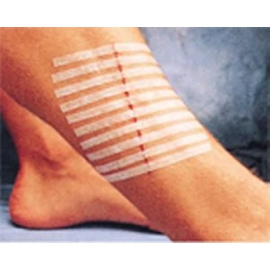 3m Steri-Strip Dikiş Bantı 12 mm x 100 mm 6 Şerit R-1547  5 Adet
