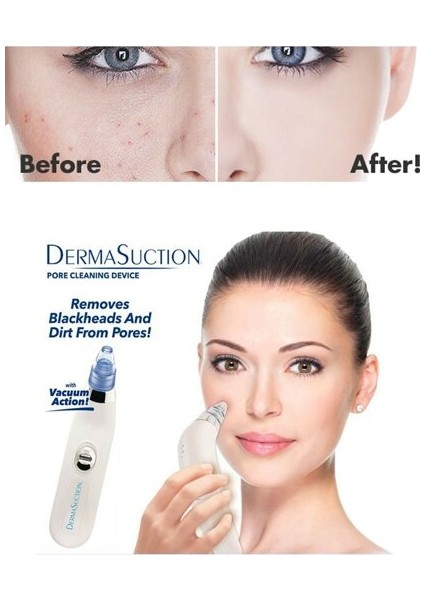 Vakumlu Siyah Nokta ve Yüz Temizleme Cihazı fiyatları