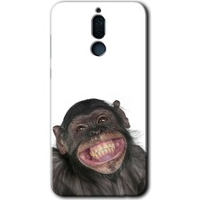 Gramaphone Huawei Mate 10 Lite Kılıf Hd Desen Baskılı Arka Kapak + Esnek Nano Cam - Şıpsevdi Aşk