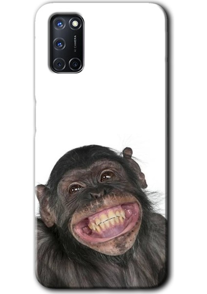 Oppo A92 Kılıf Hd Desen Baskılı Arka Kapak + Esnek Nano Cam - Şıpsevdi Aşk