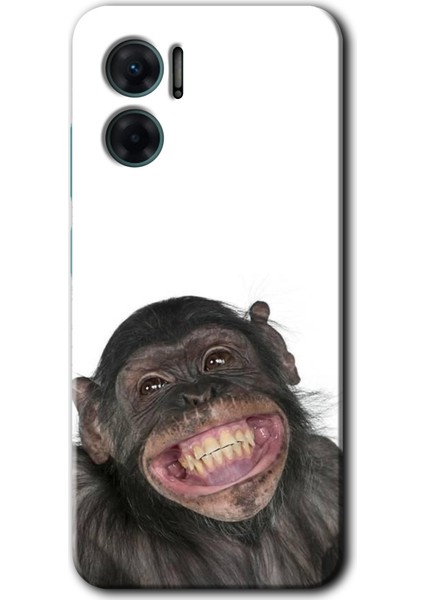 Xiaomi Redmi 10 5g Kılıf Hd Desen Baskılı Arka Kapak + Esnek Nano Cam - Şıpsevdi Aşk