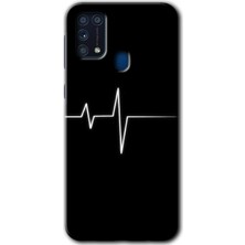 Gramaphone Galaxy M31 Kılıf Hd Desen Baskılı Arka Kapak + Kırılmaz Cam - Heart Rytm