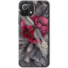 Gramaphone Xiaomi Mi 11 Kılıf Hd Desen Baskılı Arka Kapak + Esnek Nano Cam - Kelebek Ömrü