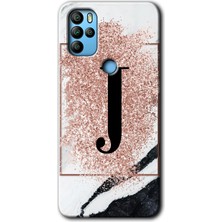 Omix X500 Kılıf Hd Desen Baskılı Arka Kapak - Pembe Mermer Desenli J Harfi