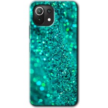 Xiaomi Mi 11 Lite Kılıf Hd Desen Baskılı Arka Kapak - Diamonds