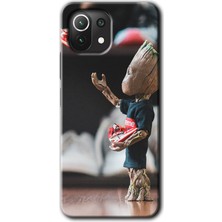 Gramaphone Xiaomi Mi 11 Kılıf Hd Desen Baskılı Arka Kapak + Kırılmaz Cam - I Am Groot