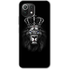 Xiaomi Mi 11 Kılıf Hd Desen Baskılı Arka Kapak + Esnek Nano Cam - King Lion