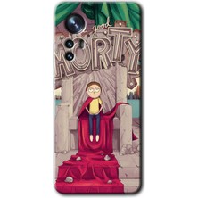 Gramaphone Xiaomi Mi 12 Kılıf Hd Desen Baskılı Arka Kapak + Kırılmaz Cam - Morty