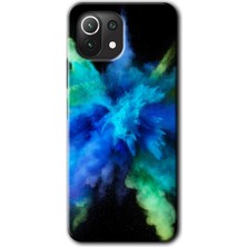 Xiaomi Mi 11 Kılıf Hd Desen Baskılı Arka Kapak - Karışım 1