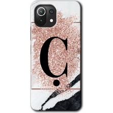 Xiaomi Mi 11 Lite Kılıf Hd Desen Baskılı Arka Kapak + Kırılmaz Cam - Pembe Mermer Desenli Ç Harfi
