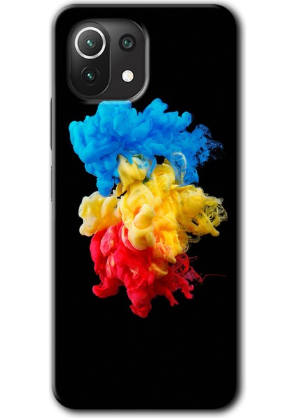 Xiaomi Mi 11 Lite Kılıf Hd Desen Baskılı Arka Kapak + Kırılmaz Cam - Black 1