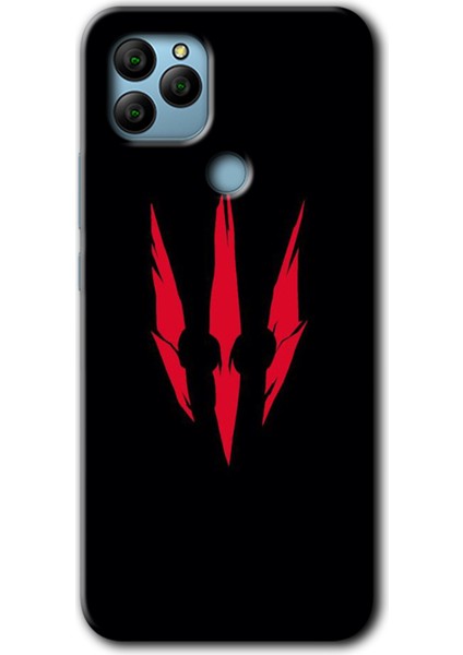 General Mobile Gm 21 Kılıf Hd Desen Baskılı Arka Kapak - Ayı Pençesi
