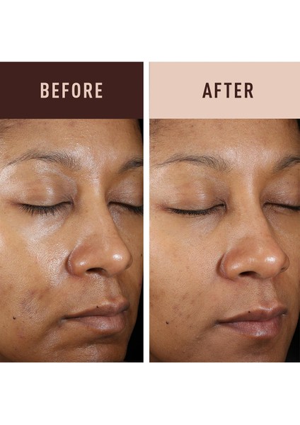 Even & Clear Koyu Leke Karşıtı Krem 30ml