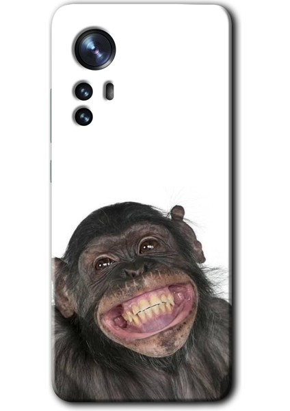 Xiaomi Mi 12 Kılıf Hd Desen Baskılı Arka Kapak + Kırılmaz Cam - Şıpsevdi Aşk