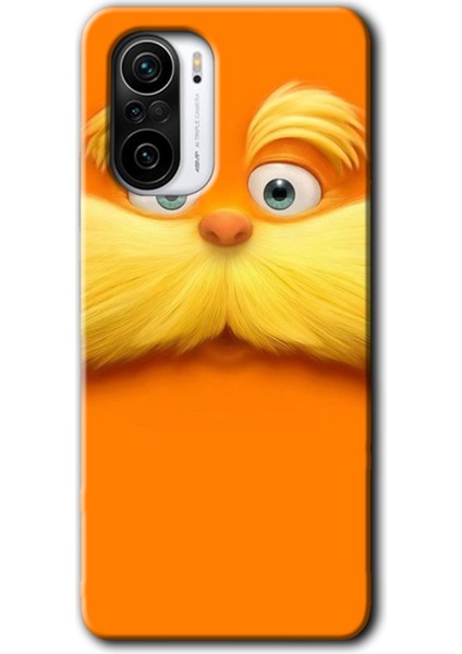 Redmi MI11I Kılıf Hd Desen Baskılı Arka Kapak - Garfield