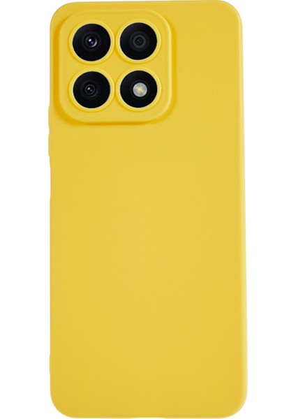 Honor X8A 4g Telefon Kılıfı (Yurt Dışından)
