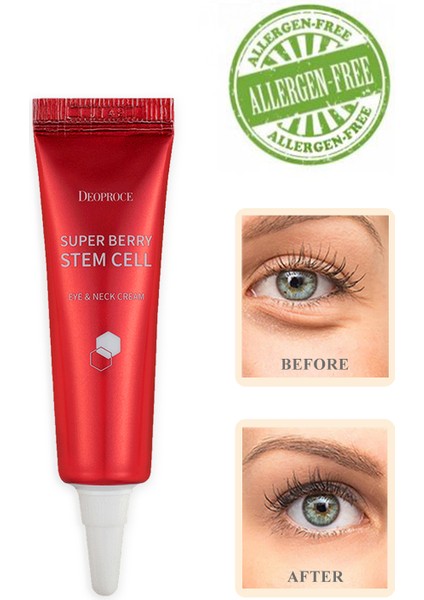 Adenozin İçeren Göz Altı Koyu Görünümü Gideren Göz &boyun Kremi 10 ml