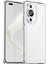 Huawei Nova 11 Pro Telefon Kılıfı (Yurt Dışından) 1